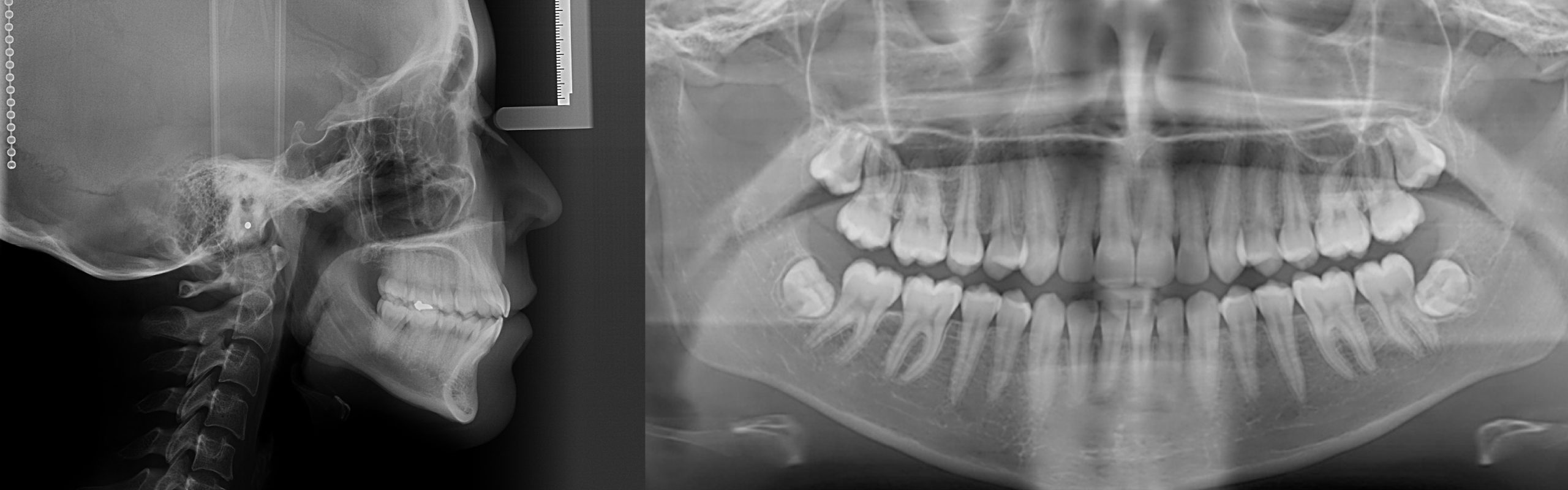 Radiografías para Ortodoncia